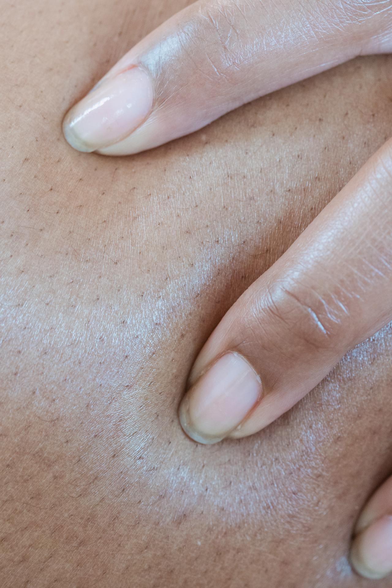 Best Hair Removal in Fayetteville, GA — 2026 Guide